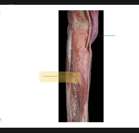 <p>Identify the highlighted arm muscle</p>