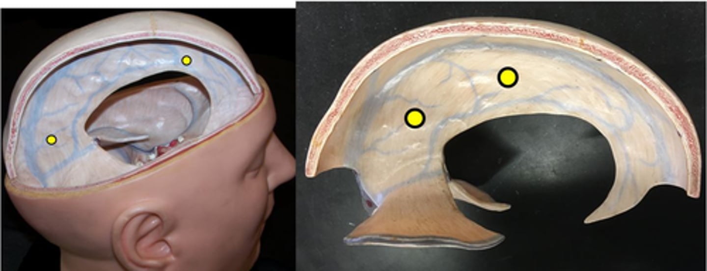 <p>separates the two cerebral hemispheres</p>