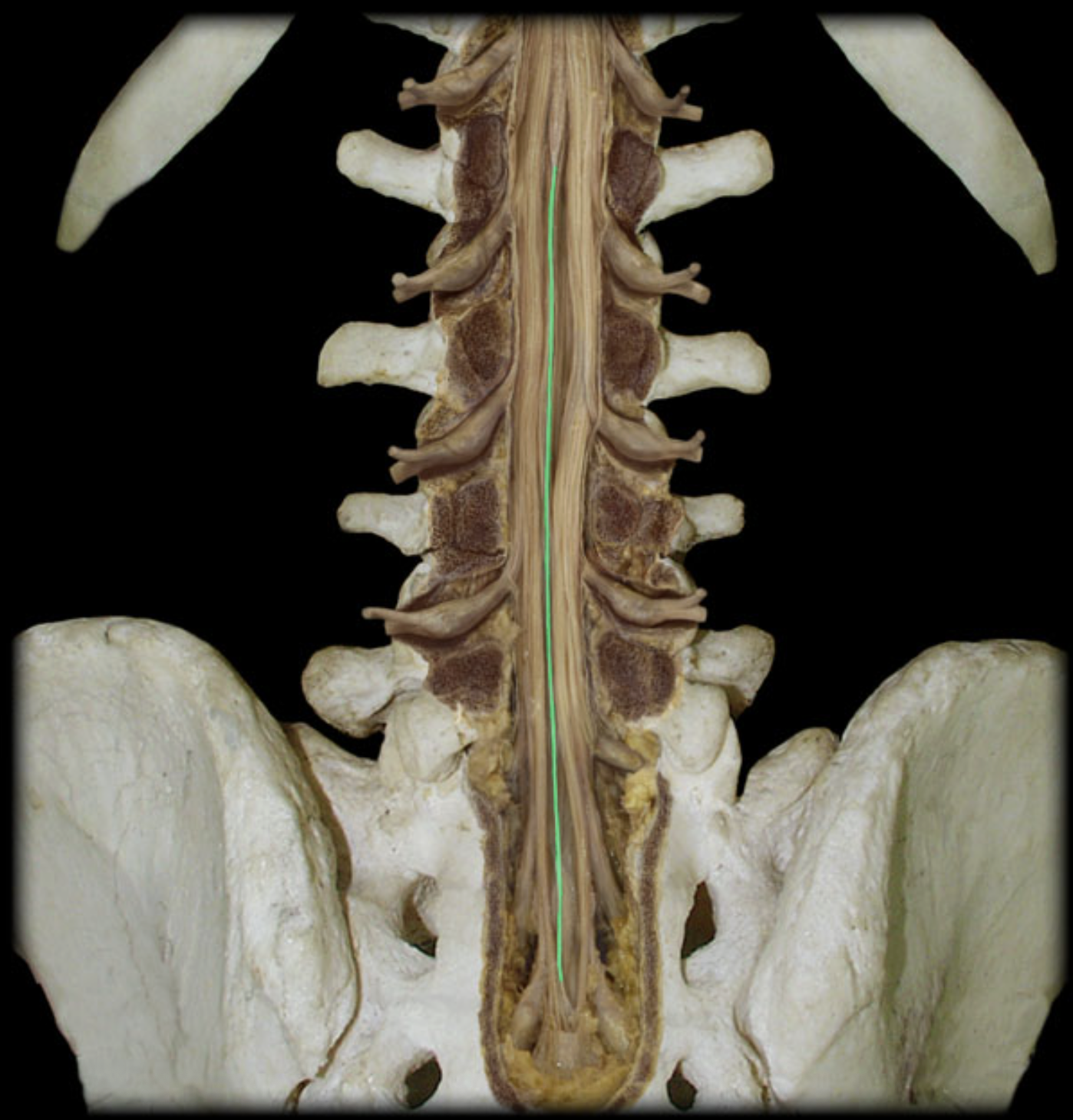 <p>What is the highlighted structure? (green)</p>