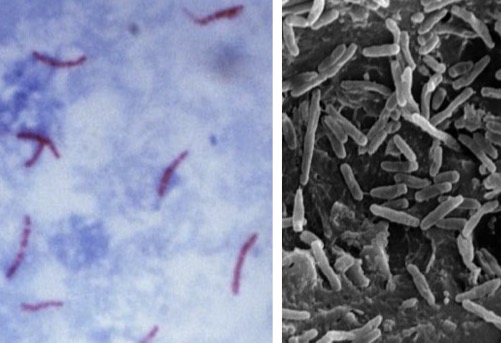 <p>Genus: Mycobacterium</p>
