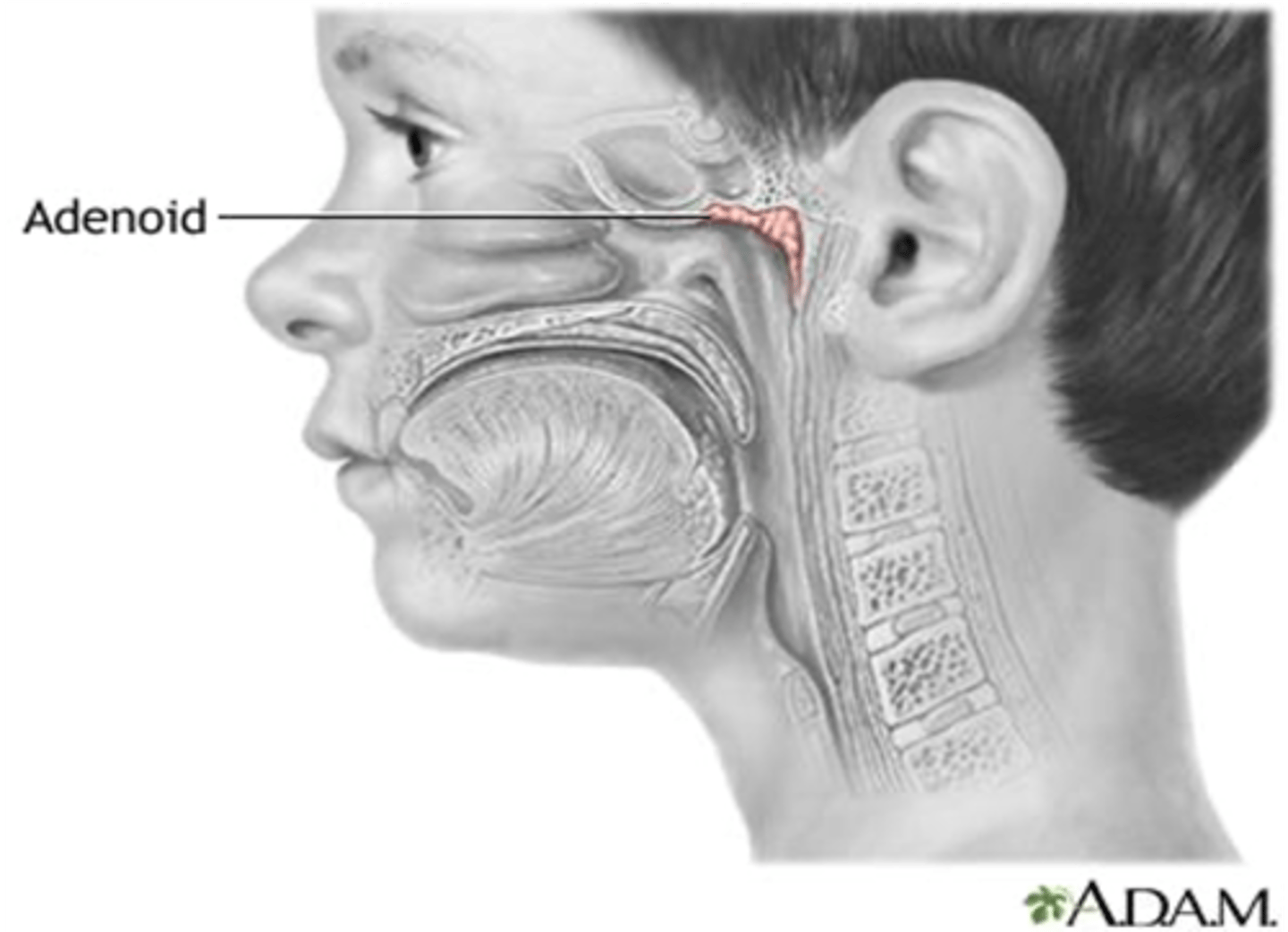 <p>Adenoid</p>