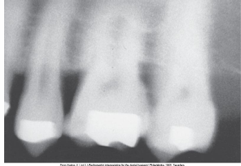 <p>How would you resolve this Movement/Motion Unsharpness X-ray?</p>