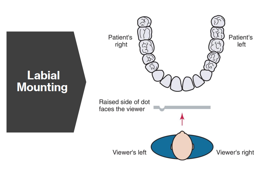 <p>Labial mounting is the standard (and preferred) method of mounting dental radiographs where:</p><ul><li><p>The viewer’s perspective is as if looking at the patient face-to-face</p></li><li><p>The patient’s right side is on your left, and left is on your right</p></li><li><p>The raised dot on the film faces toward the viewer (convex side)</p></li></ul><p>Used for both intraoral and extraoral film mounting to ensure consistent interpretation.</p>
