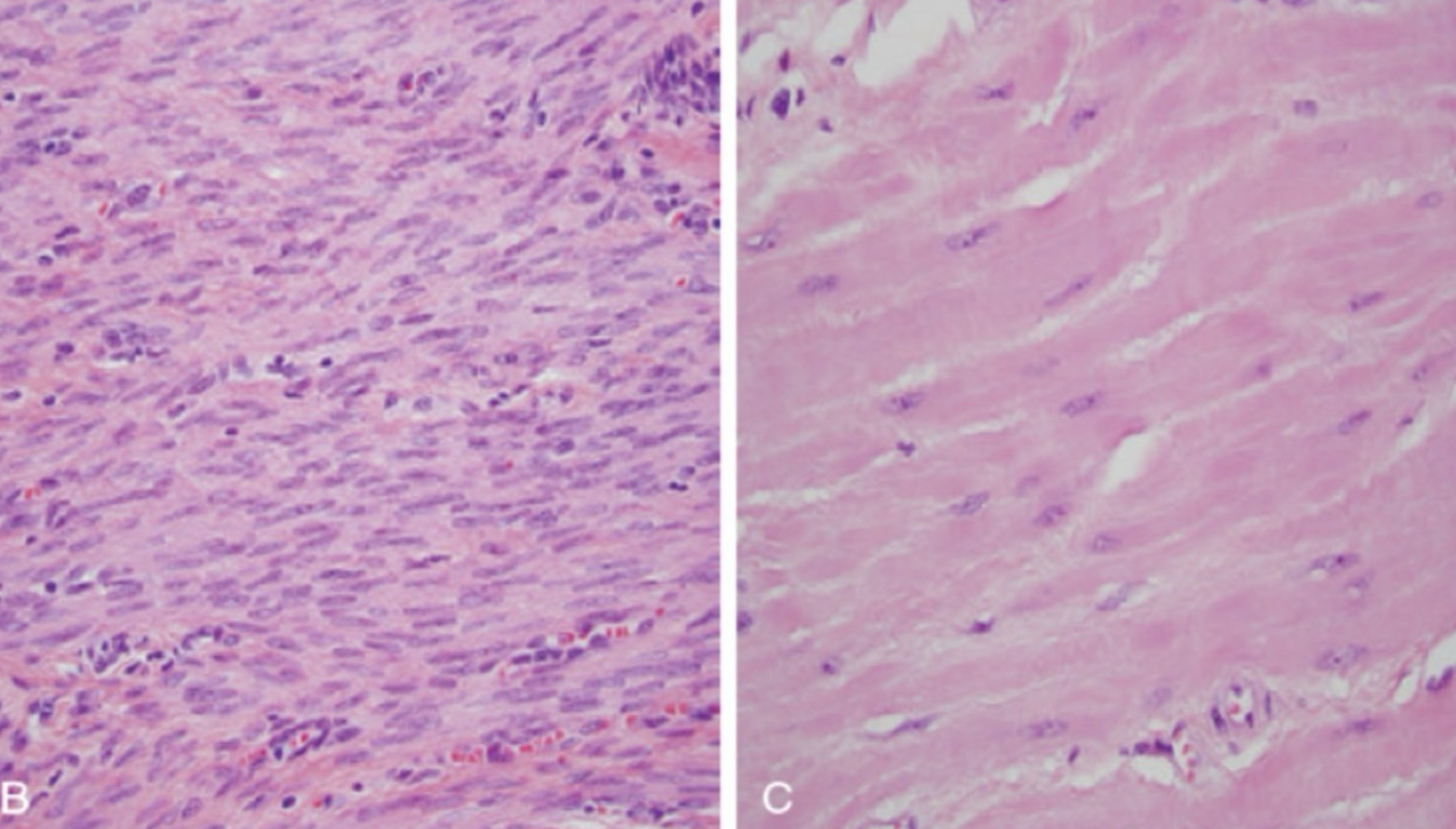 <p>what type of cell adaptation is depicted</p>