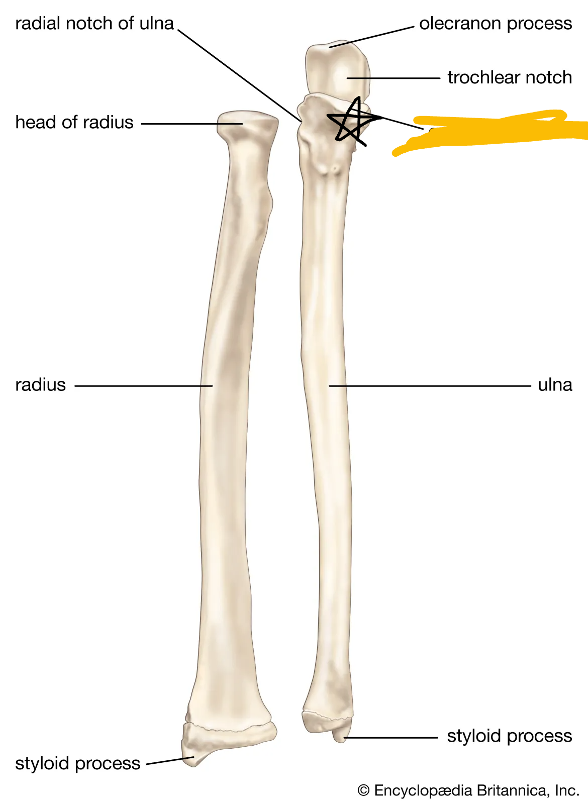 <p>process of ulna on anterior side and proximal side (anterior view right hand picture)</p>