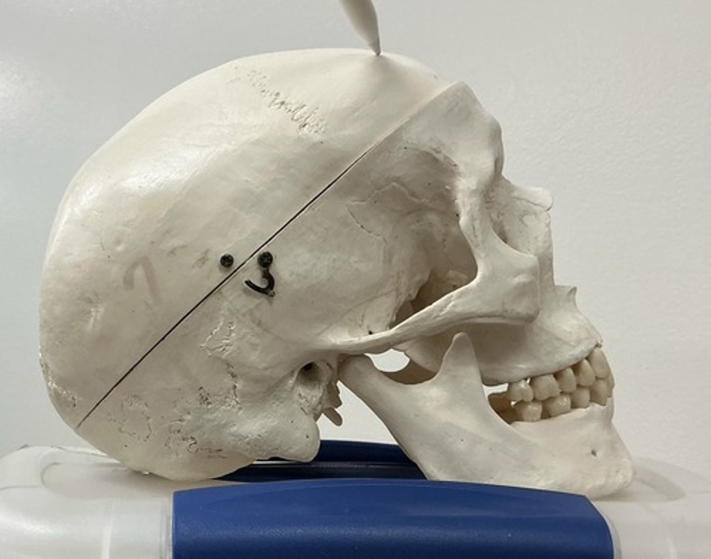 <p>What bone is this?</p>