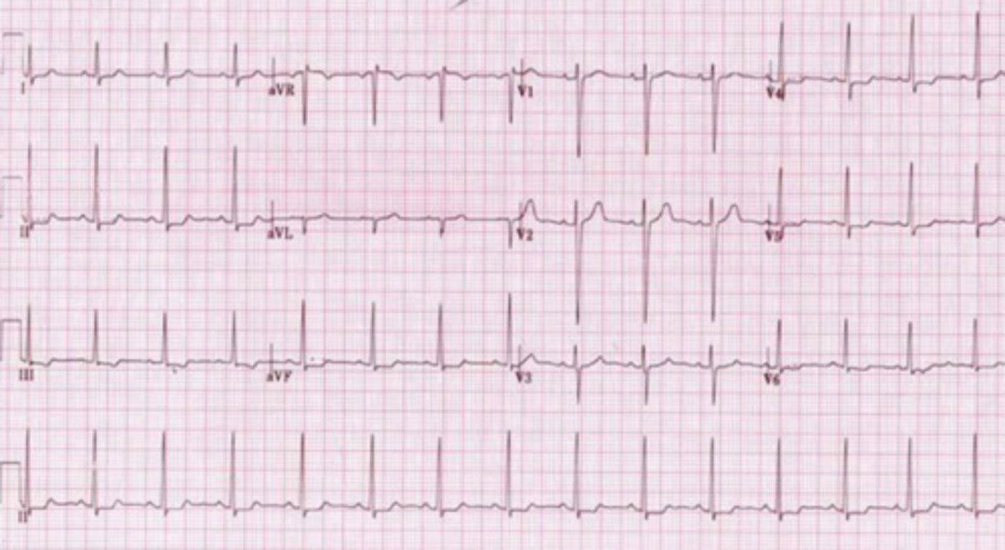 <p>What are the findings</p>