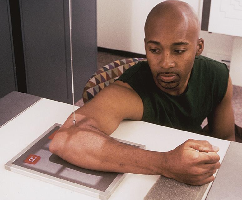 <p>lateral elbow</p><ul><li><p>elbow and humerus in same plane&nbsp;</p></li><li><p>wrist and forearm are aligned/rotated</p></li></ul><p></p>