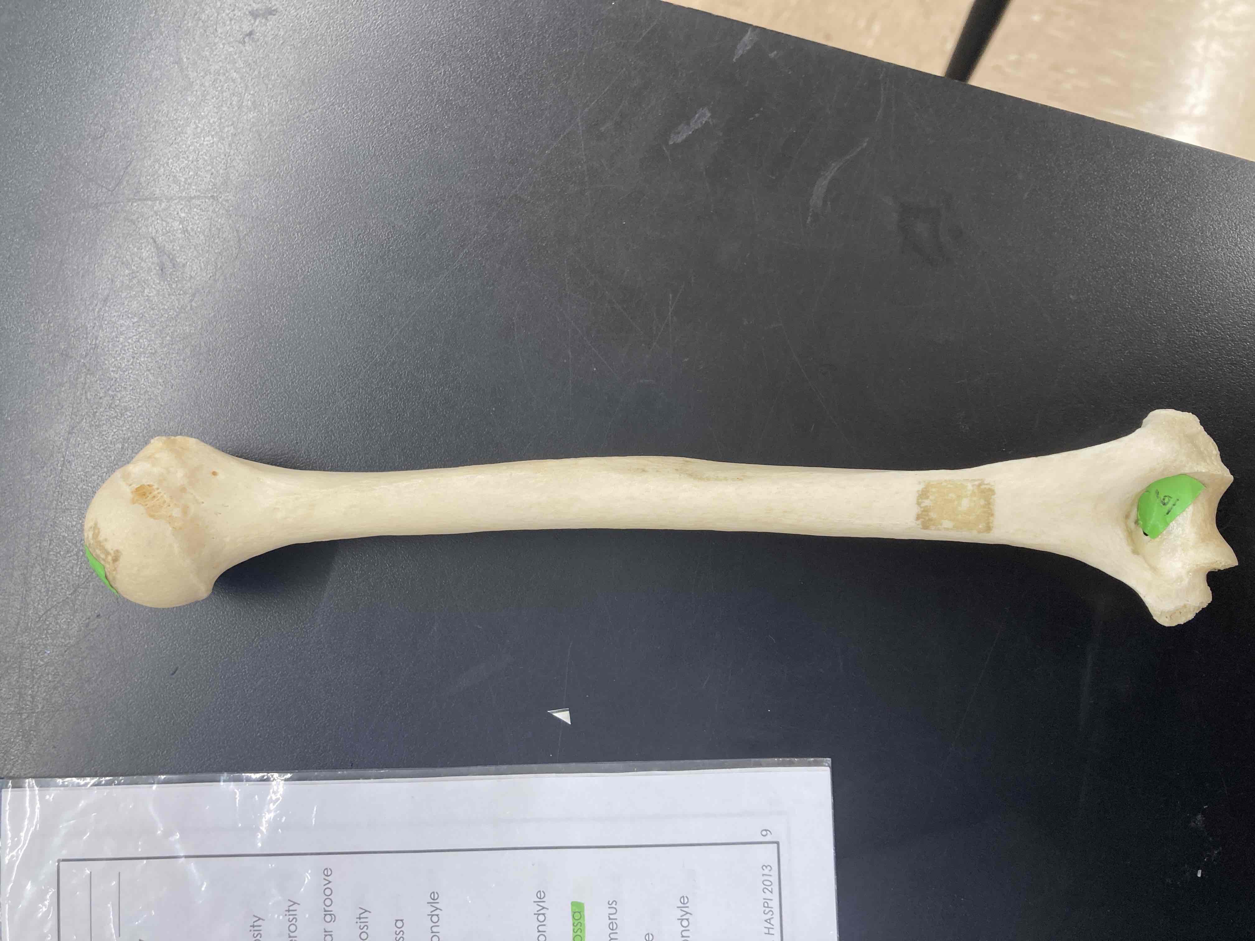 <p>What is the name of this bone?</p>