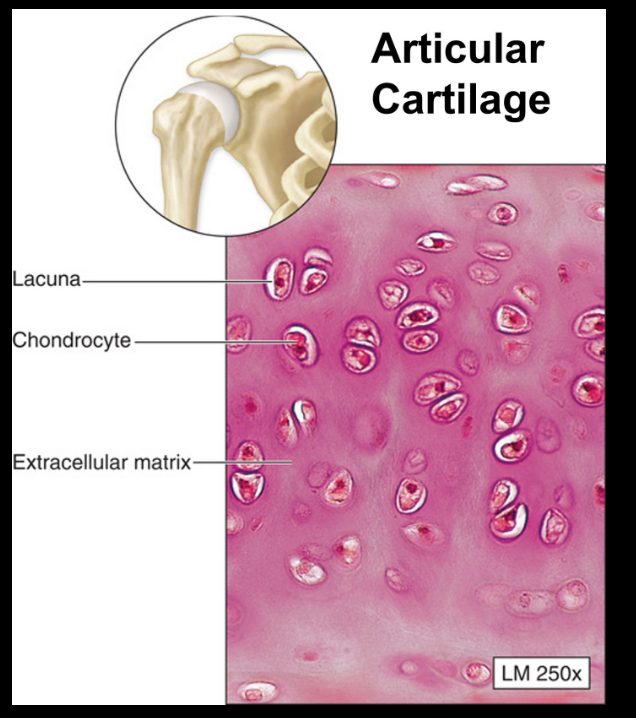 <ul><li><p>most common and weakest</p><ul><li><p>not much fibers</p></li><li><p>no blood vessels</p></li></ul></li><li><p>found of articular surface</p></li><li><p>ground substance is solid</p></li></ul><p></p>