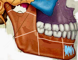 <p>What part of the mandible?</p>