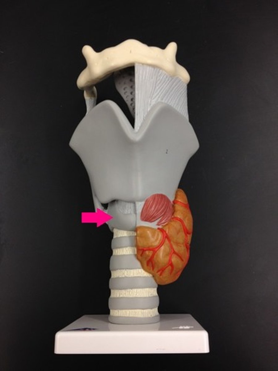 <p>Identify the structure.</p>