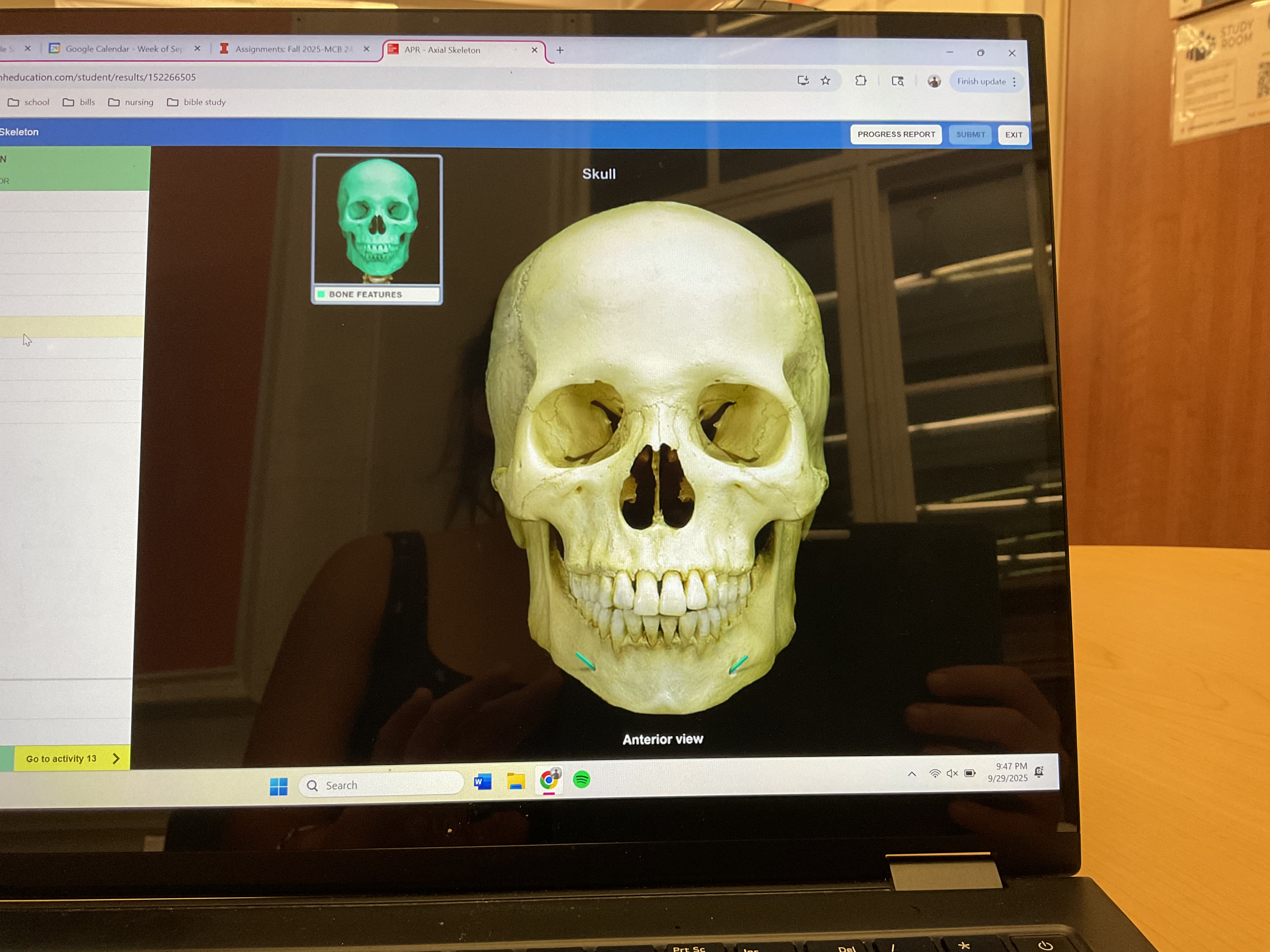 <p>Mental foramen</p>