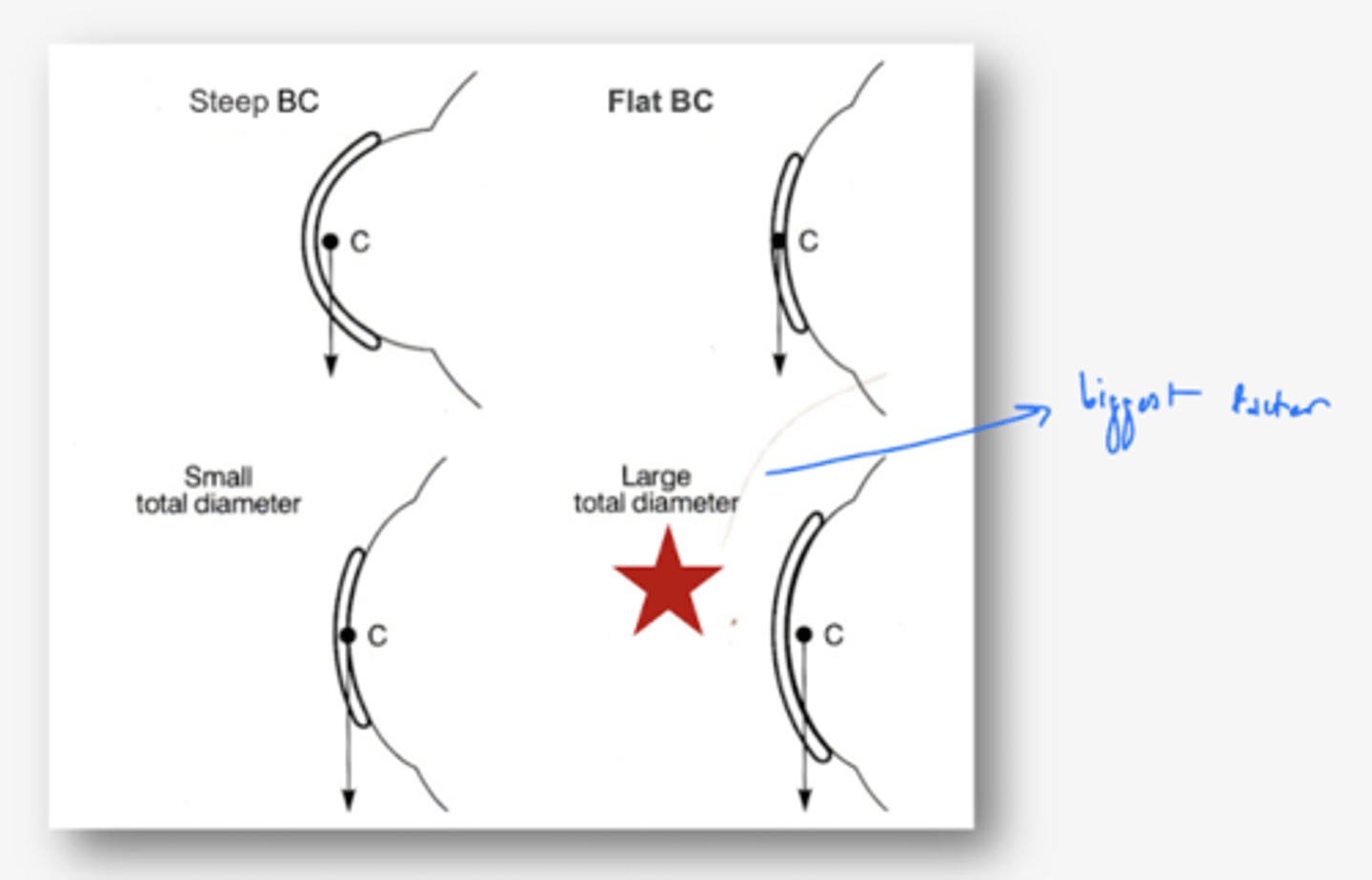 <p>lens diameter → 4-7x more important than thickness or power (size of lenses)</p>