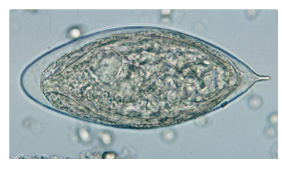 <p>Figure B: ________ in a wet mount of urine concentrates, showing the characteristic terminal spine</p>