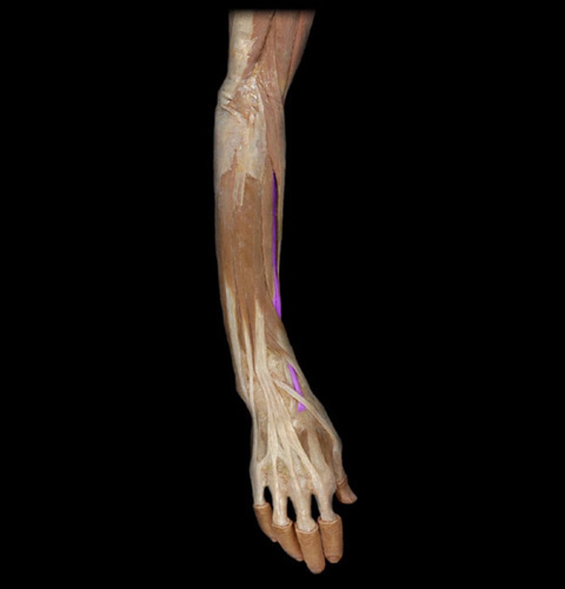 <p>Lateral supracondylar ridge</p><p>Base of 2nd metacarpal</p>