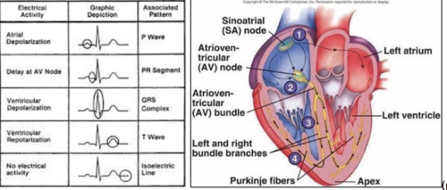 <p>Rationale</p><p>1. Junctional rhythm originates from the atrioventricular junction instead of the sinoatrial node, which normally causes the P wave. Therefore, the P wave will be missing. R, S, T waves come from the ventricles after stimulation from the atrioventricular junction and will be unaffected.</p><p>2. R waves come from the ventricles after stimulation from the atrioventricular junction and will be unaffected.</p><p>3. S waves come from the ventricles after stimulation from the atrioventricular junction and will be unaffected.</p><p>4. T waves come from the ventricles after stimulation from the atrioventricular junction and will be unaffected.</p>