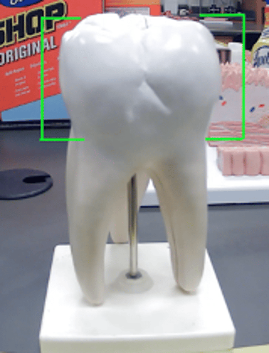 <p>What is this body feature?</p>