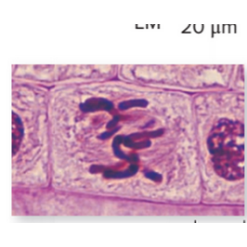 <p>What kind of cell is shown? Name the phase that it is experiencing.</p>