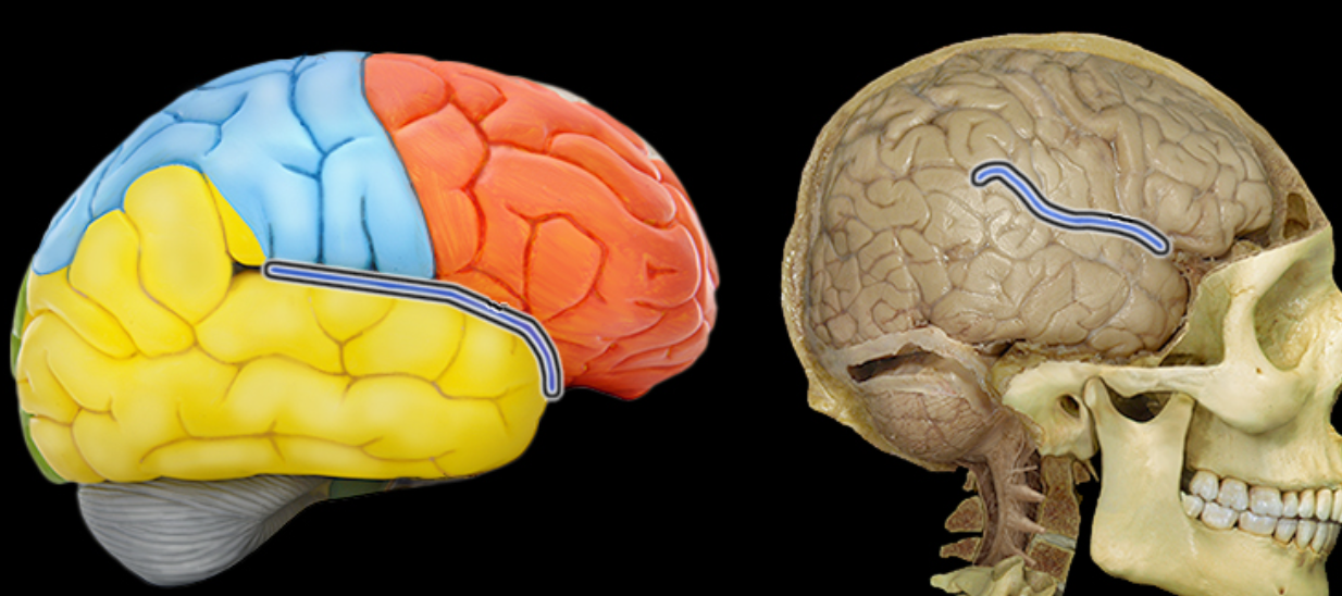 <p>Location:</p><ul><li><p>Lateral aspect of each cerebral hemisphere</p></li></ul><p>Description:</p><ul><li><p>Deep groove separating temporal from frontal and parietal lobes</p></li></ul><p></p>