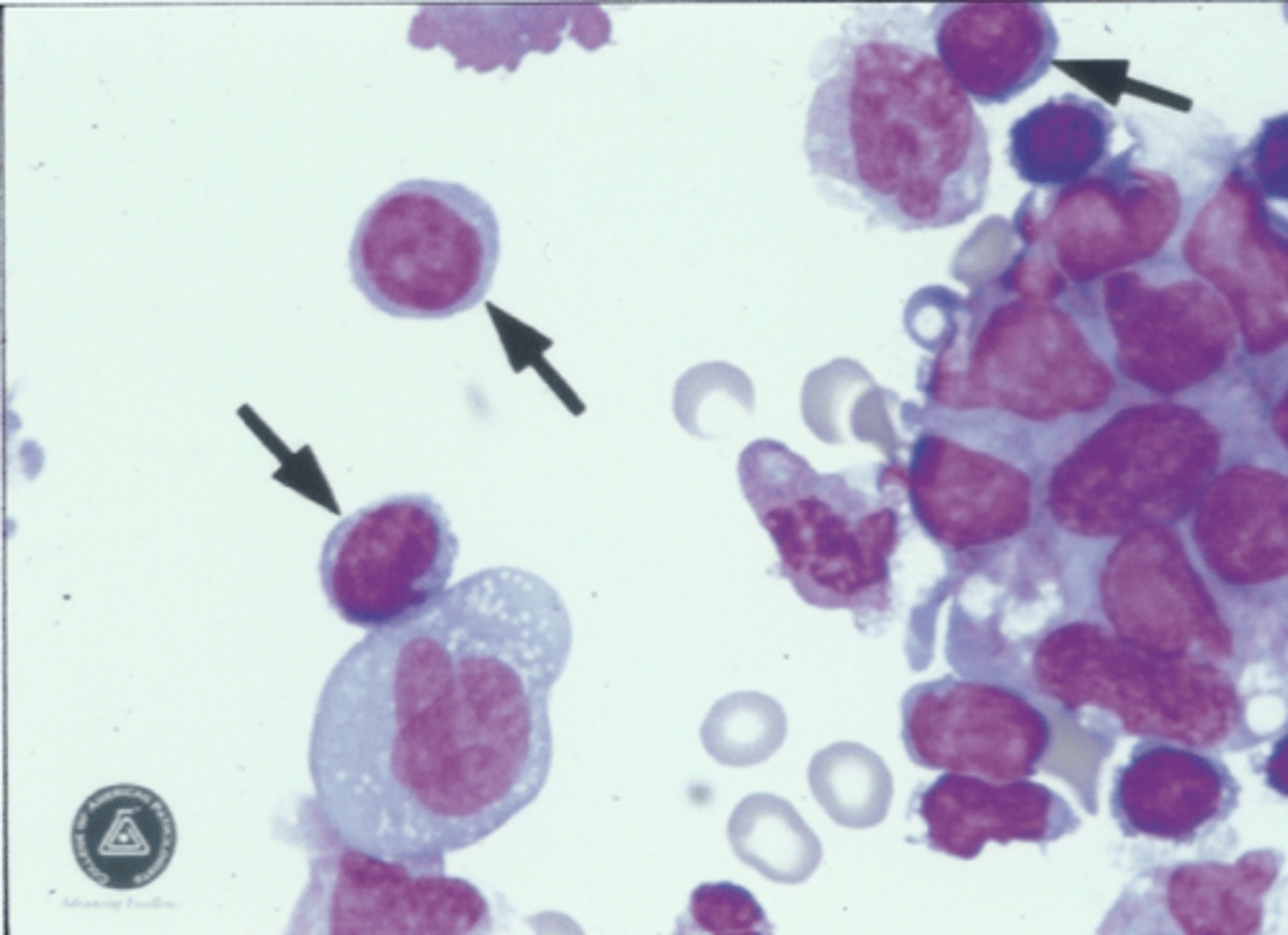 <p>Identify the cells in this body fluid</p>