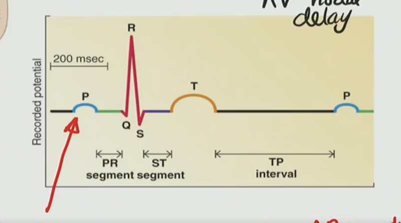 <p><strong>What does the P-wave on the ECG represent?</strong> </p><p>A. Ventricular depolarization<br>B. Atrial repolarization<br>C. Atrial depolarization<br>D. Ventricular repolarization</p>