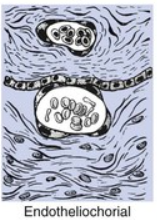 <p>Endotheliochorial placentation</p>