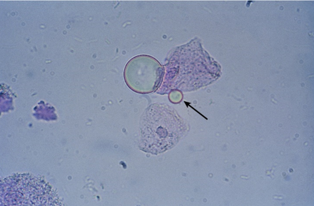 term image