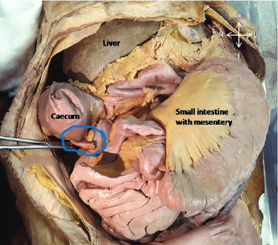 <p>a small pouch connected to the large intestine</p>