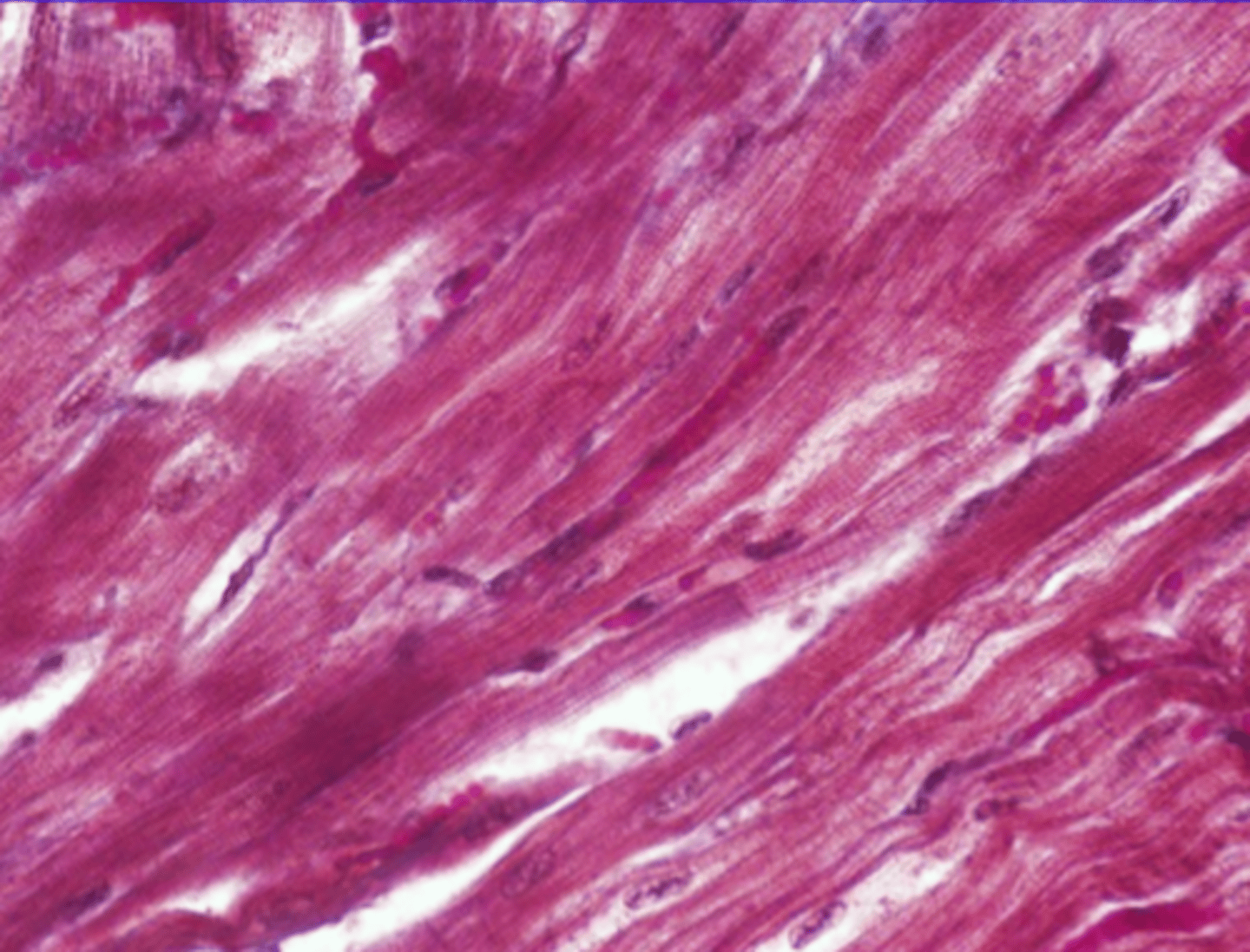 <p>Appears striated. However, cells are branched anduninucleate</p><p>Location: the heart</p><p>Function: pump the heart</p>