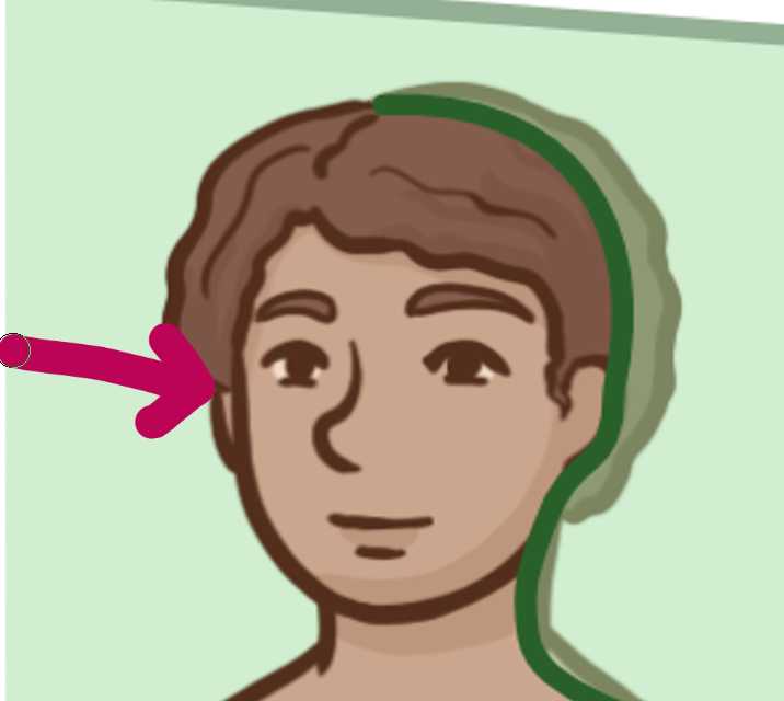 <p>Which brain-body orientation is this</p>
