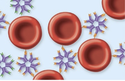 <p>This figure shows the result of interaction of RBC antigens (A antigens) with the antibody against the RBC antigen (anti-A antibodies). What is this result called?</p>