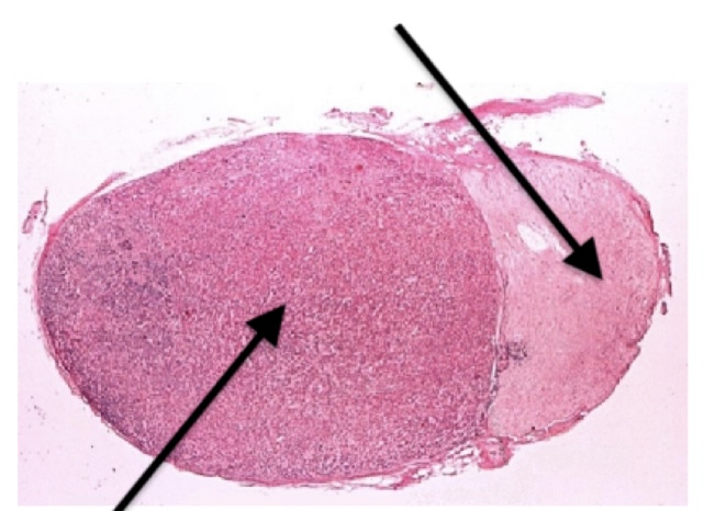 <p>Adenohypophysis</p>