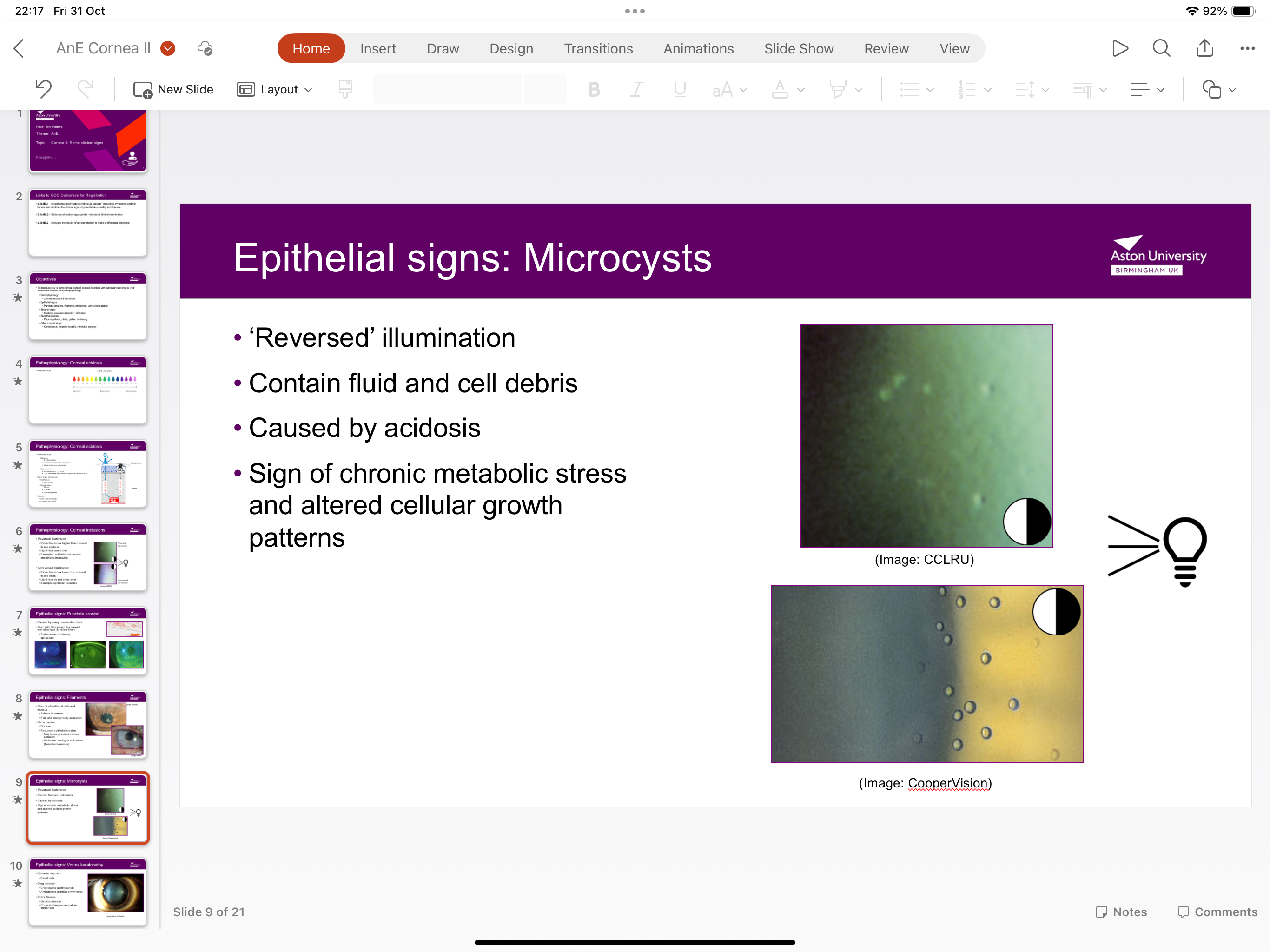 <p>Contains fluid and cell debris and is caused by acidosis and is a sign of chronic metabolic stress and altered cellular growth patterns</p>