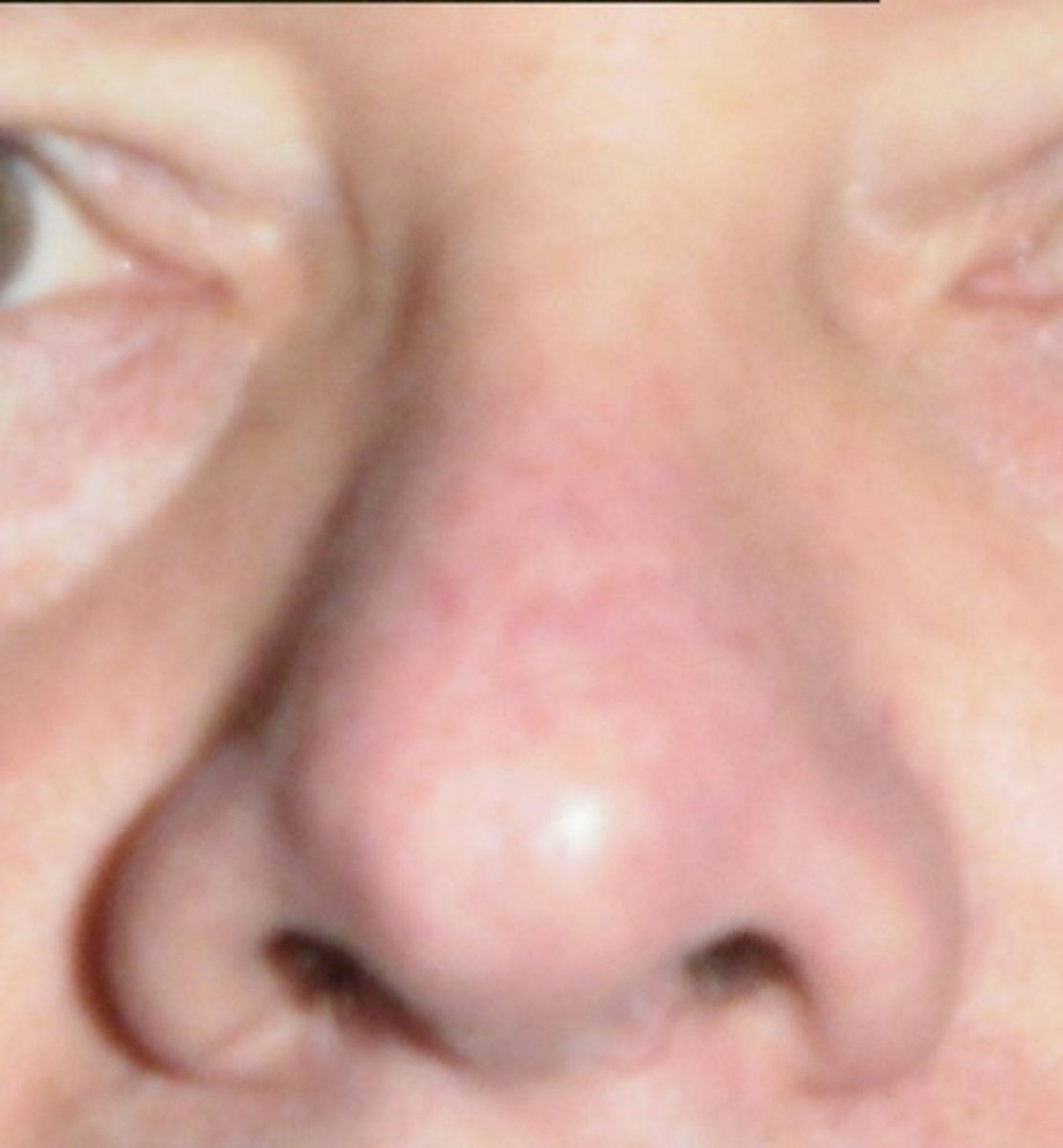 <p>Nose</p>