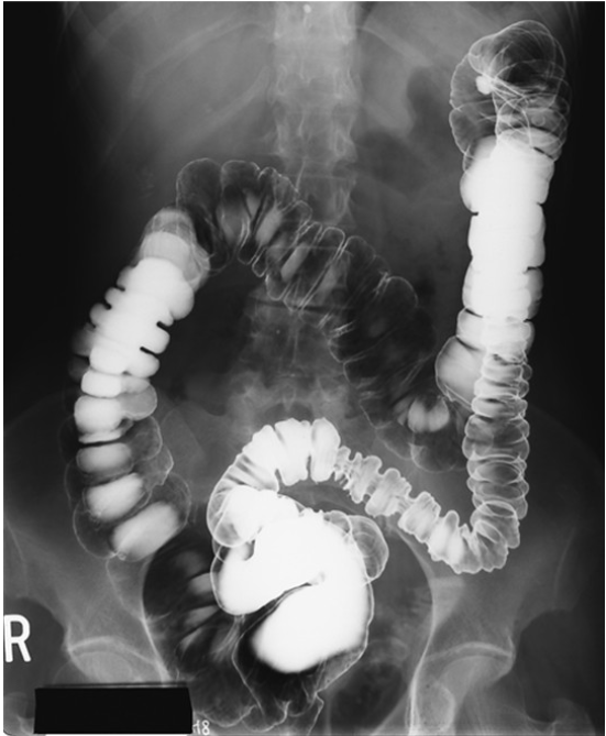 <p><span>What contrast procedure was performed to produce this image?</span></p>