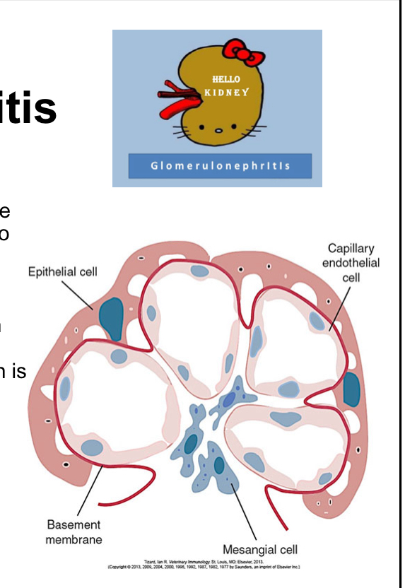 <p>describe glomerulonephritis </p>