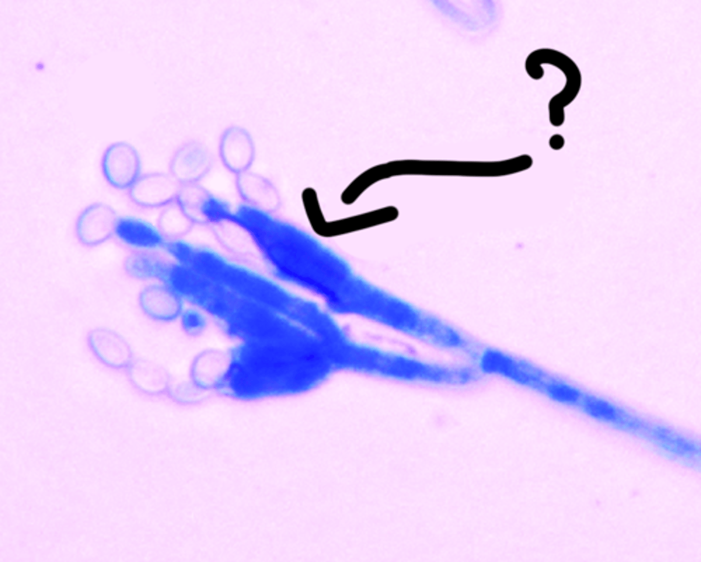 <p>Specialized hyphal structure found in fungi that produces and bears conidia, often arising from the mycelium or aerial hyphae.</p>