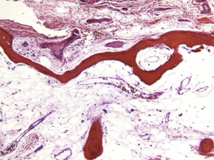 <p>What does this histo slide show?</p>