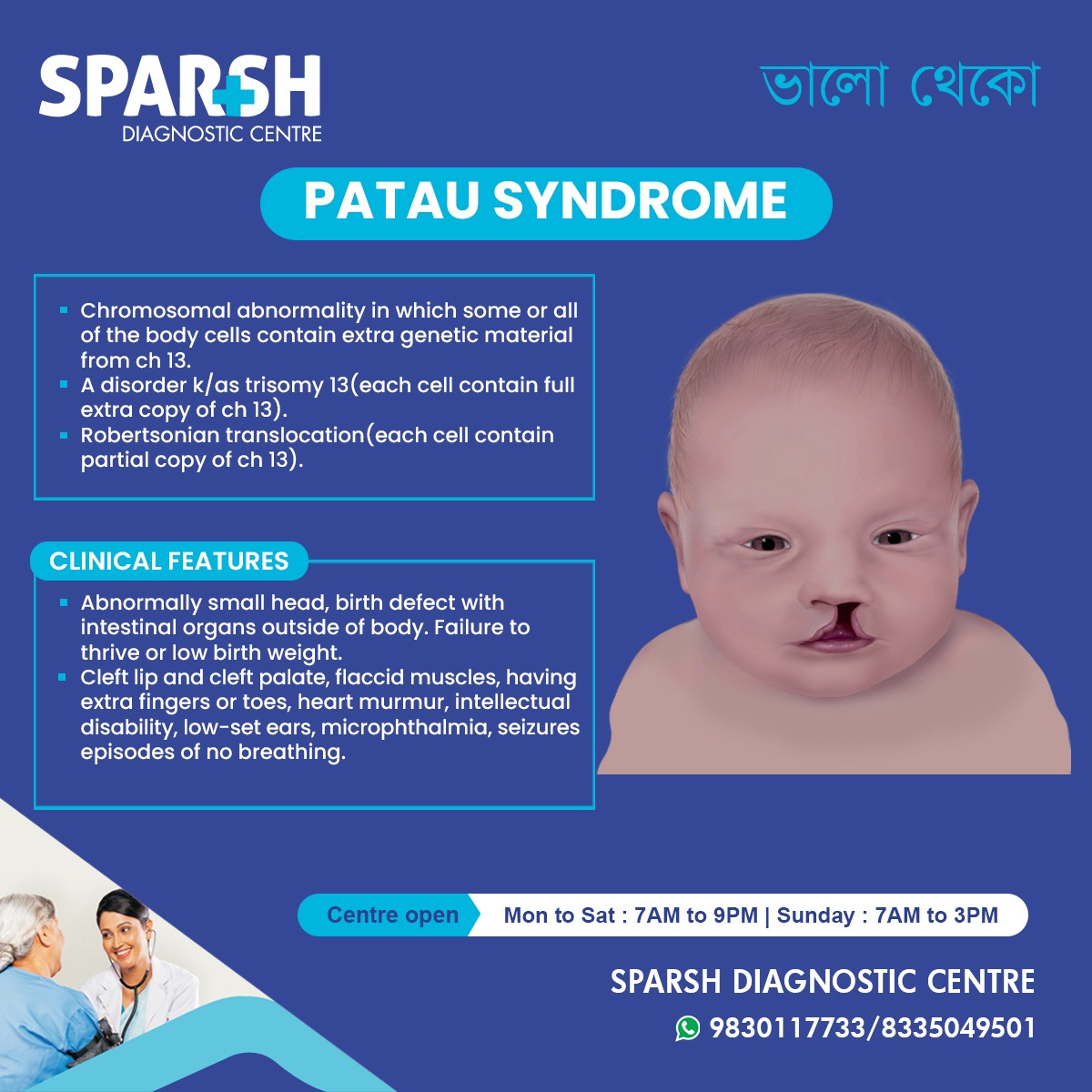 <p>Patau Syndrome (Trisomy 13)</p>