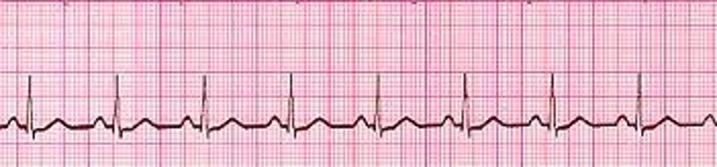 <p><strong>nhịp điệu, sự nhịp nhàng</strong></p><p>- <em>Breathing and sleeping are examples of </em><strong><em><span class="bgP">biological</span></em></strong><em> <span class="bgY">_____</span> in humans.</em> <em>(nhịp điệu sinh học)</em> </p><p>- <em>I've got no </em><strong><em><span class="bgP">sense of</span></em></strong><em> <span class="bgY">______</span>, so I'm a terrible dancer.</em></p>