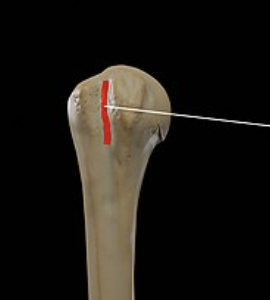 <p>Landmark Name:</p>