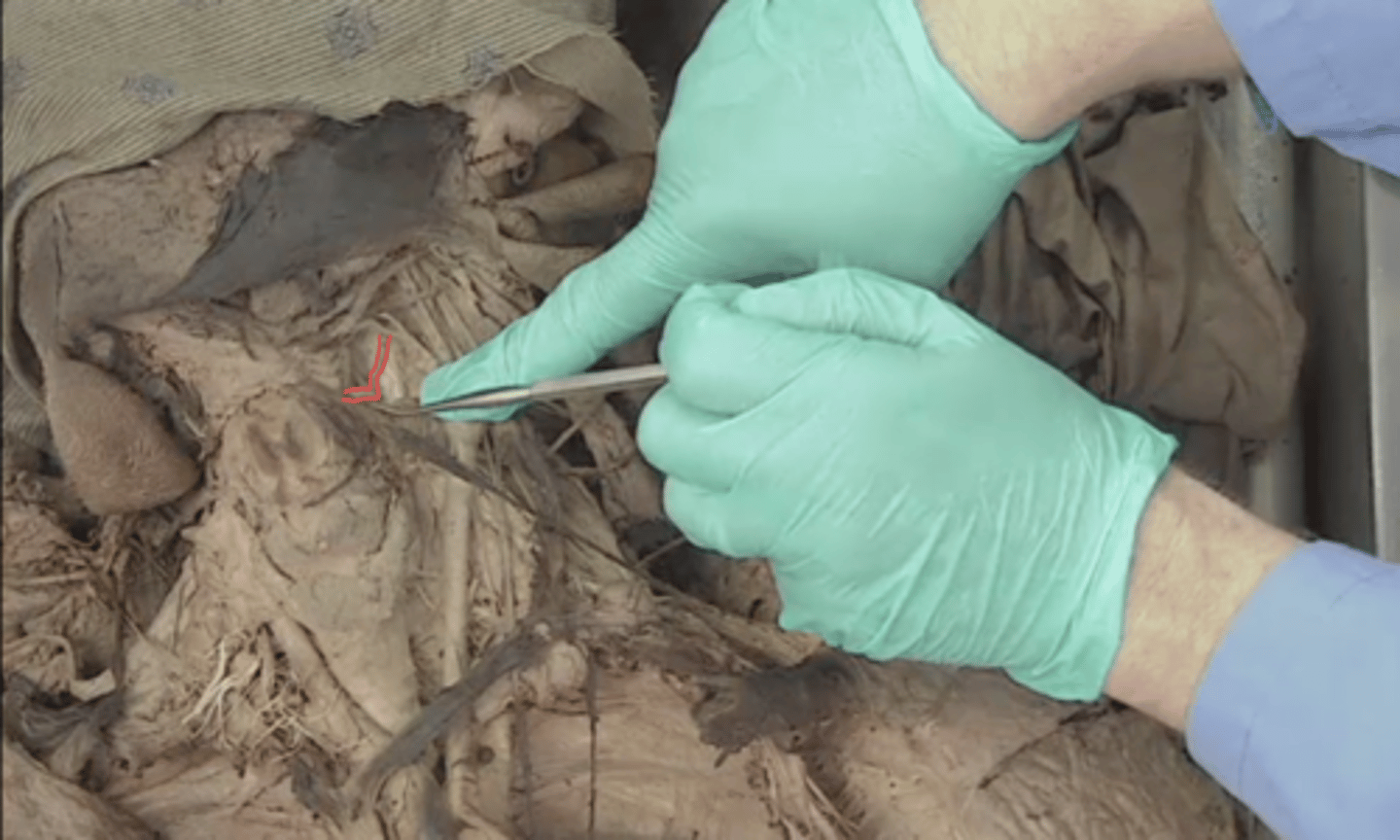 <p>identify this nerve (behind external carotid artery)</p>