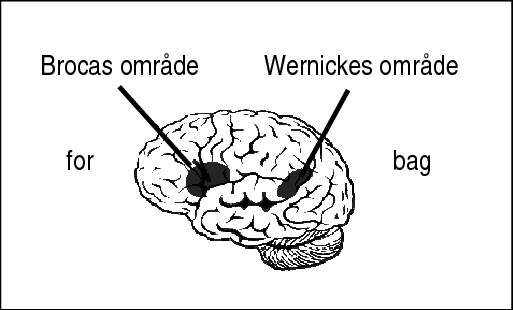 <p>Wernickes område</p>