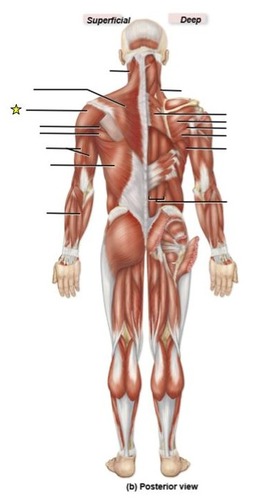 <p>identify the muscle</p>