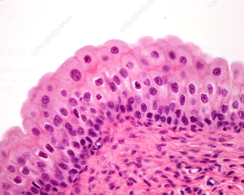 <p>Transitional (Epithelial) </p>