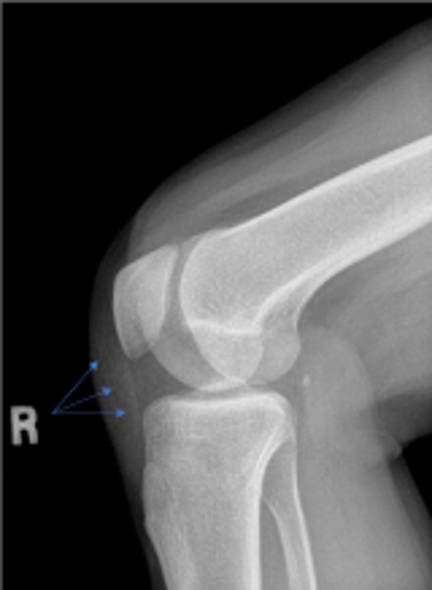 <p>What is outlined?</p>