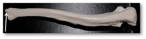 Name this specific part of the ulna.