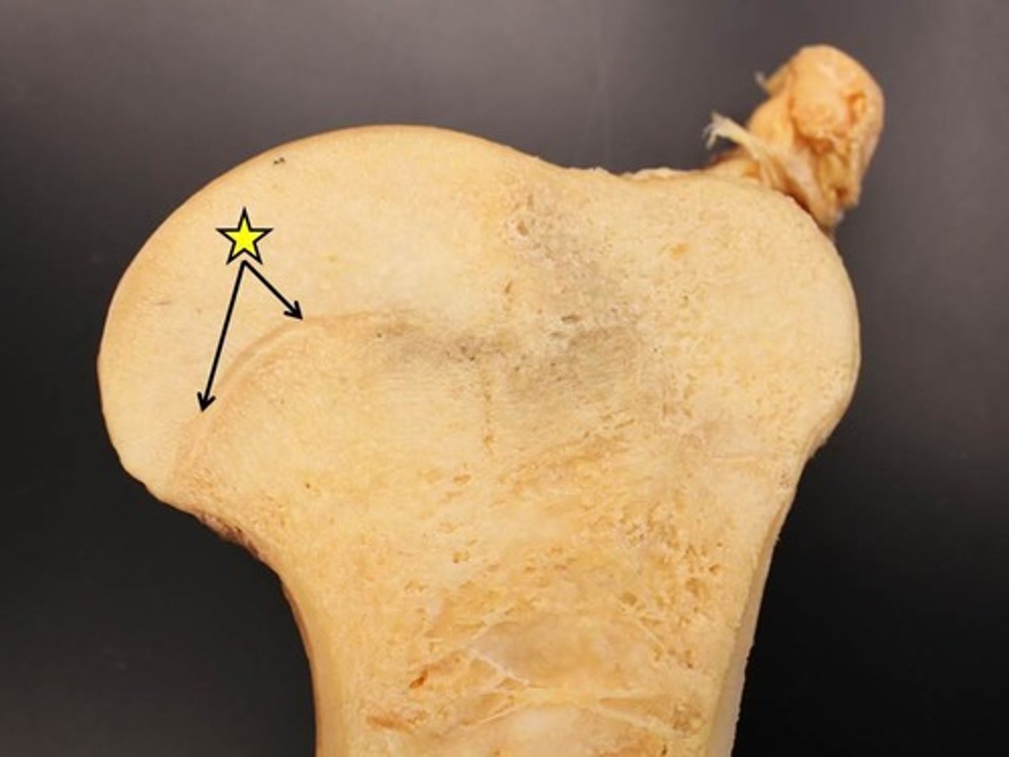 <p>where bone growth takes place</p>