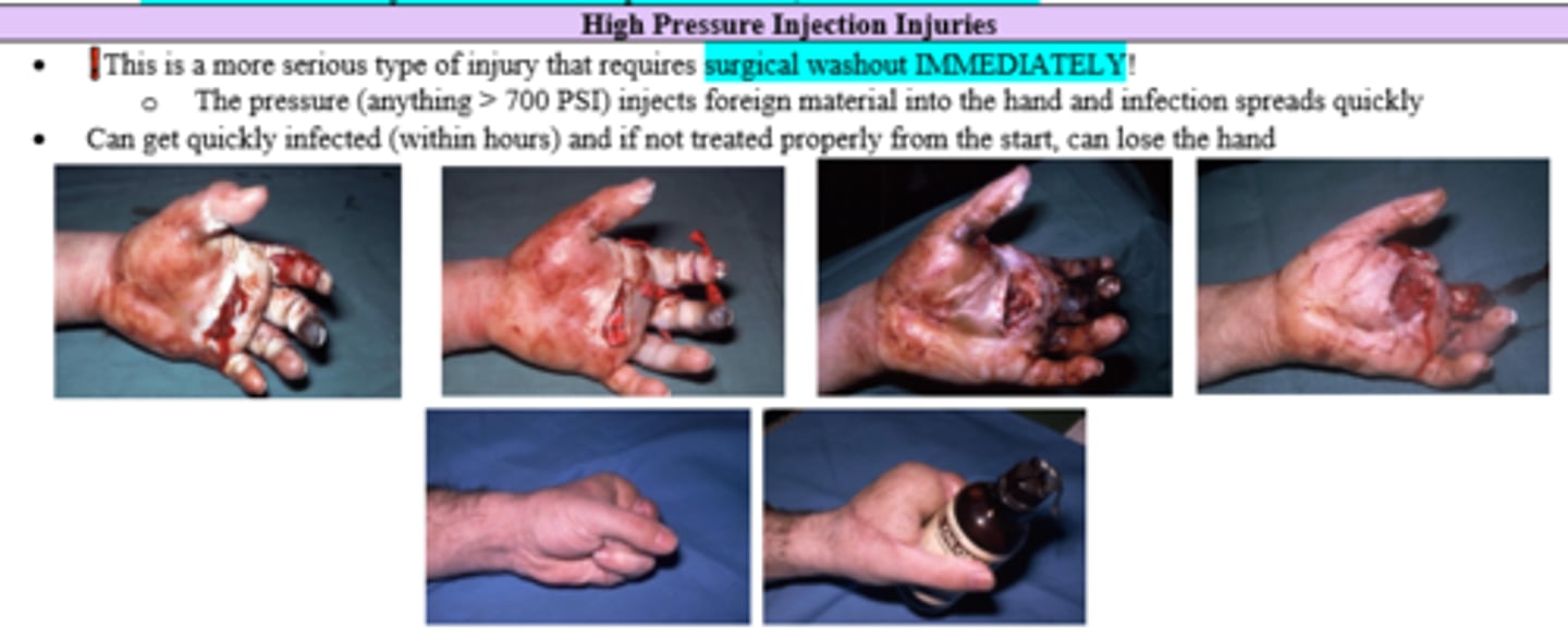 <p>Surgical wash out (gets infected within hours)</p>